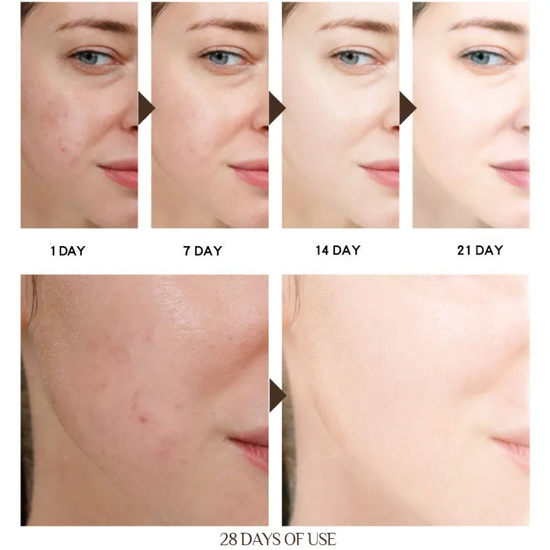 BEAUTYCOME Face Collagen Cream Anti Wrinkle Anti Aging Dark Spot Remover For Face Serum Whitening Cream Face Creams Skin Care