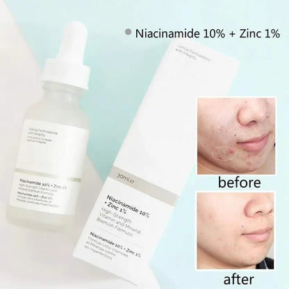 The Ordinary AHA 30% Exfoliating Fruit Acid Essence Remove Acne Mark Improve Dull Melanin Inhibition Brighten Anti-aging Care
