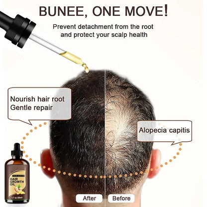 Powerful Hair Growth Oil Prevent Hair Loss Products Essence Liquid Treatment for Men and Women Repair Shampoo Hair Care