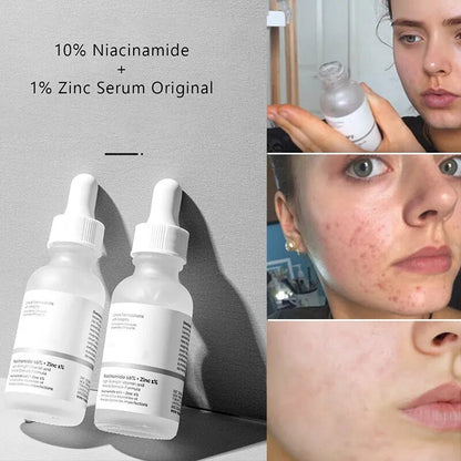 The Ordinary AHA 30% Exfoliating Fruit Acid Essence Remove Acne Mark Improve Dull Melanin Inhibition Brighten Anti-aging Care