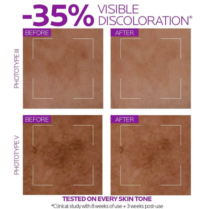 30ml Original La Roche-Posay  Essence RETINOL B3/HYALU B5/NIACINAMIDE 10/CICAPLAST B5/VC10 Serum Face Whitening Facial Skin Care