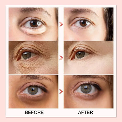 AUQUEST Dark Circles Remover Eye Cream Peptide Anti-Puffiness Eye Bags Wrinkle Cream Moisturizing Skin Lifting Firming Eye Care