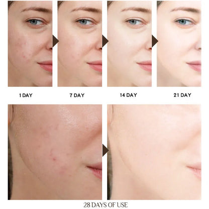 BEAUTYCOME Face Collagen Cream Anti Wrinkle Anti Aging Dark Spot Remover For Face Serum Whitening Cream Face Creams Skin Care
