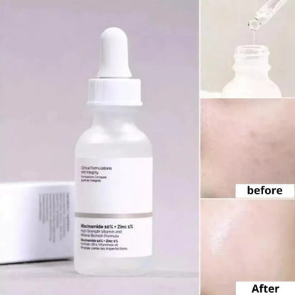 The Ordinary AHA 30% Exfoliating Fruit Acid Essence Remove Acne Mark Improve Dull Melanin Inhibition Brighten Anti-aging Care