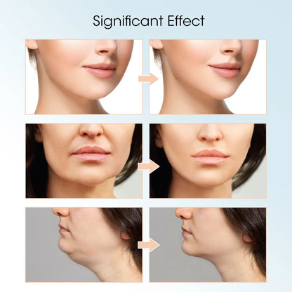 Facial Lifting Massager with Remote Control
