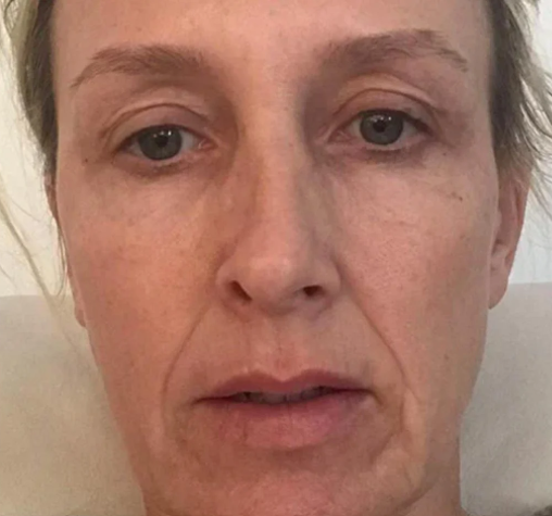 Before using Nomowrinkler